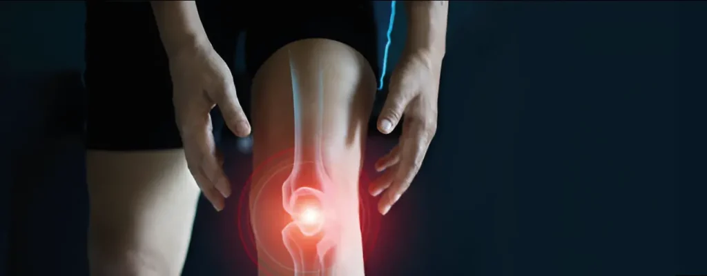 Myths-About-Knee-Pain